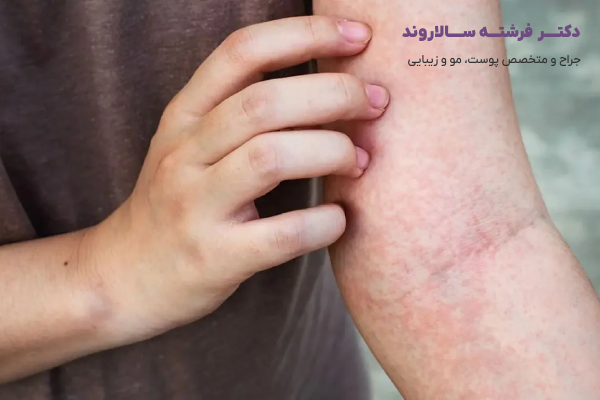 انواع بیماری های پوست