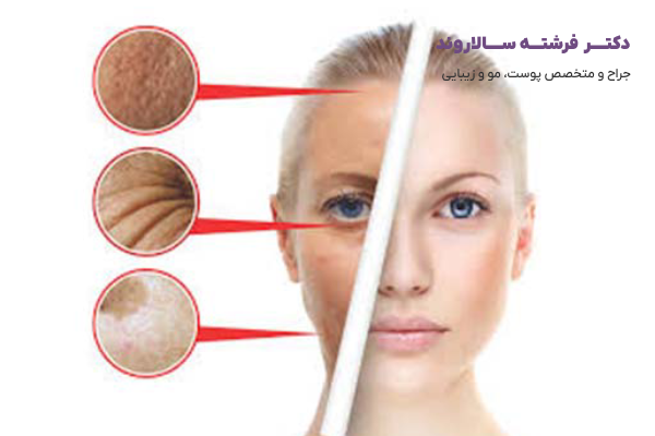 تزریق بوتاکس برای چه کسانی مناسب نیست؟
