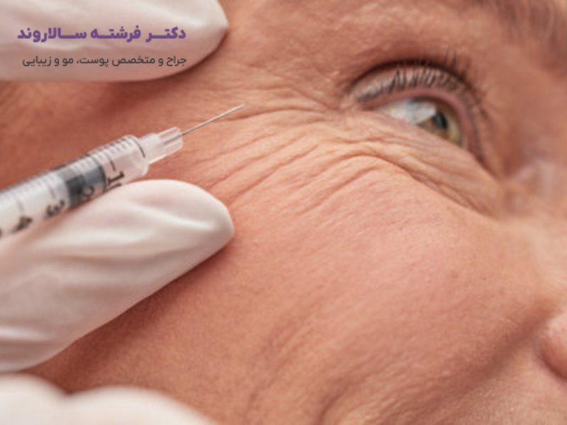 تزریق فیلر - شاخص