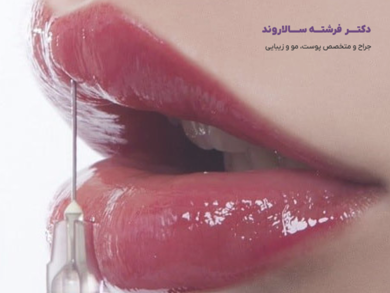 تزریق ژل لب