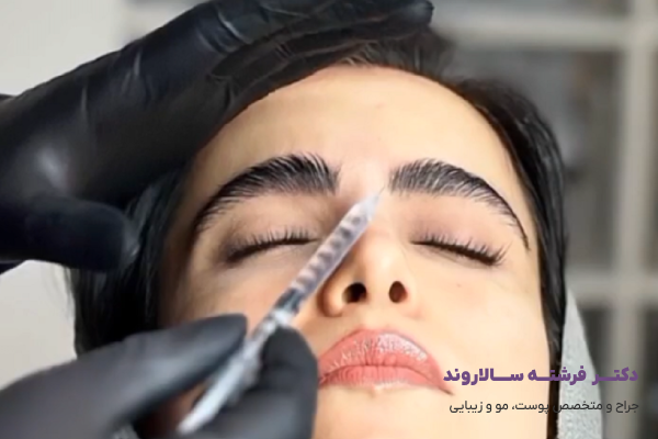مزایای لیفت چشم و ابرو با بوتاکس