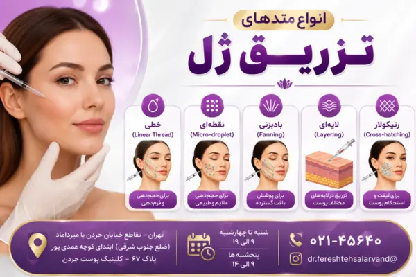 انواع متدهای تزریق ژل