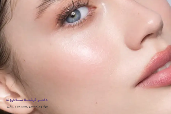 مراقبتهای بعد از تزریق فیلر گونه