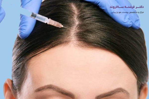 مزوتراپی مو چیست؟