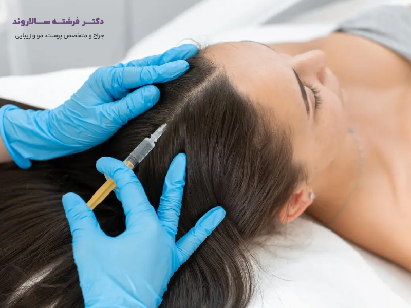 مزوتراپی مو