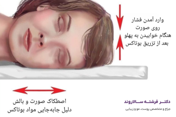 چه زمانی بعد از بوتاکس باید نگران شوید