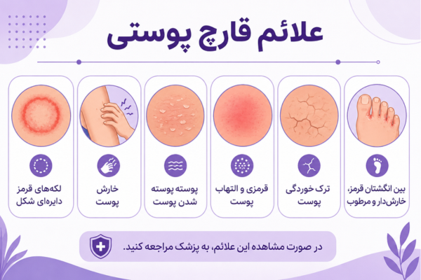 علائم قارچ پوستی