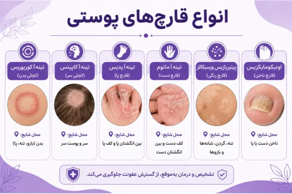 انواع قارچهای پوستی