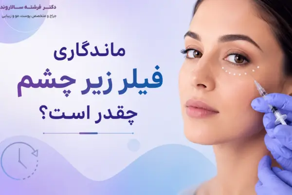 ماندگاری فیلر زیر چشم چقدر است؟
