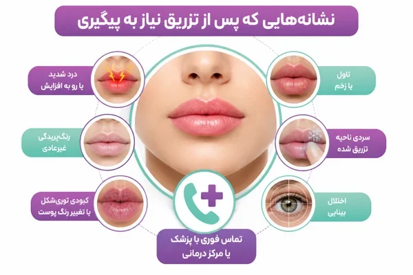 علائم هشدار پس از تزریق فیلر لب