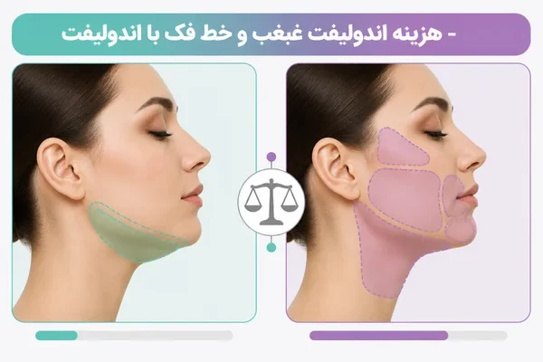 مقایسه درمان غبغب با چند ناحیه صورت